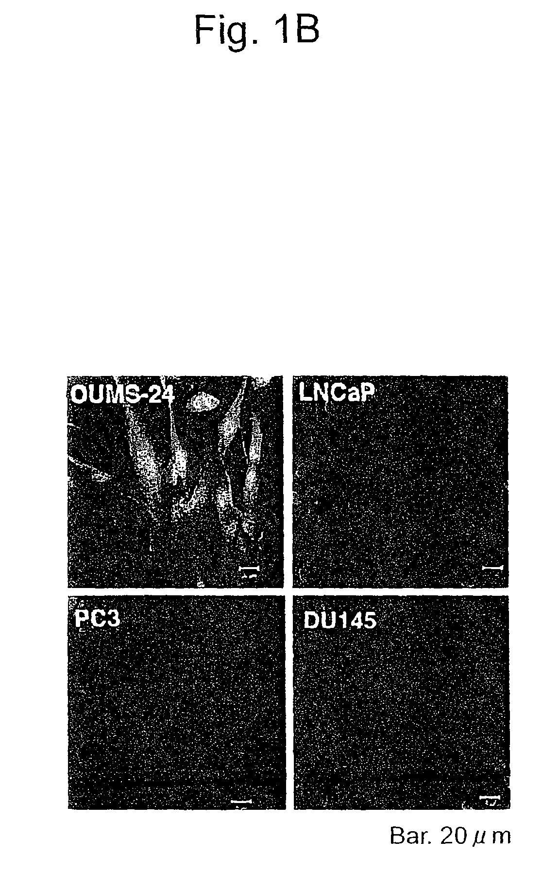 Apoptosis-inducing agent for prostate cancer cells