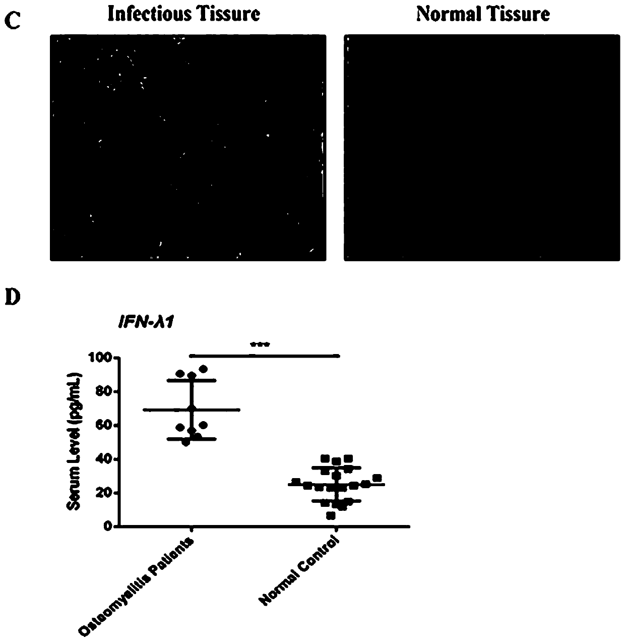 Application of recombinant IFN-lambda1 protein in preparation of a medicine for preventing and treating inflammation-induced bone loss