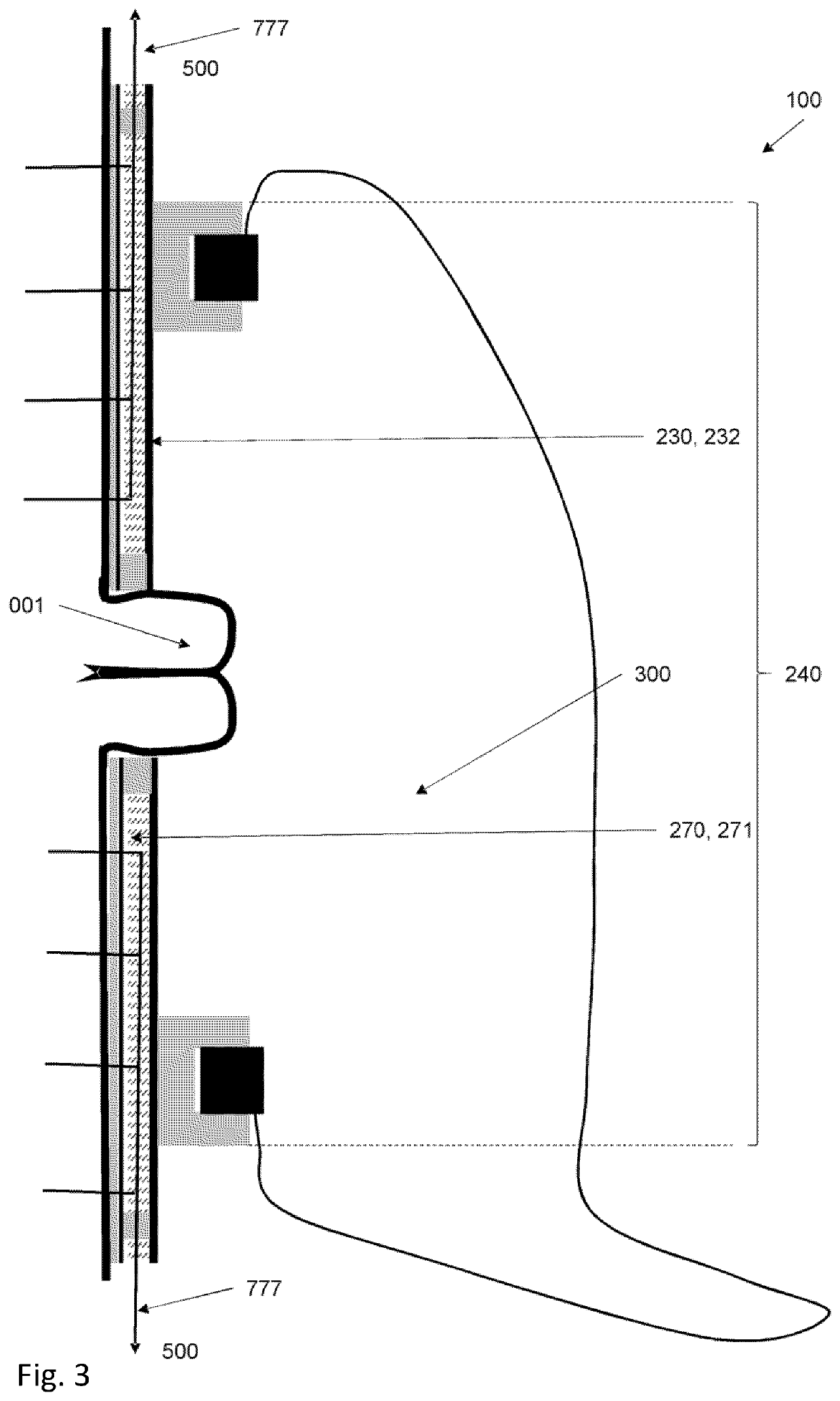 Ostomy wafer construction