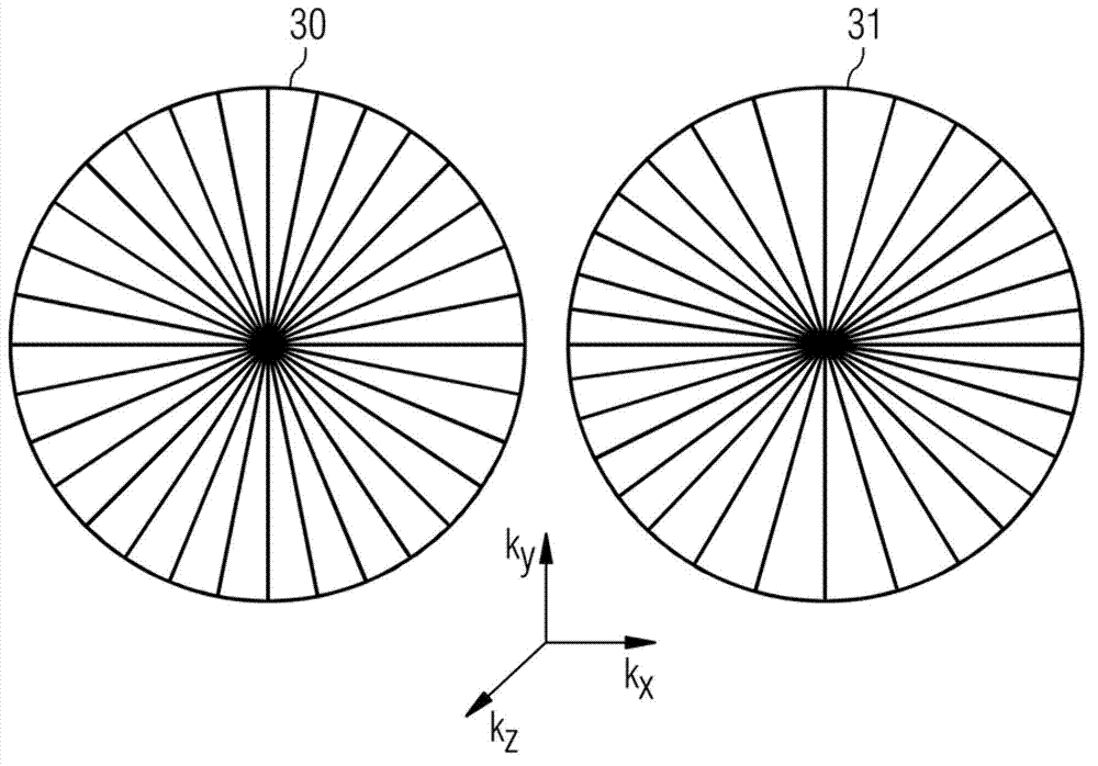 MR-angiography with non-cartesian signal acquisition