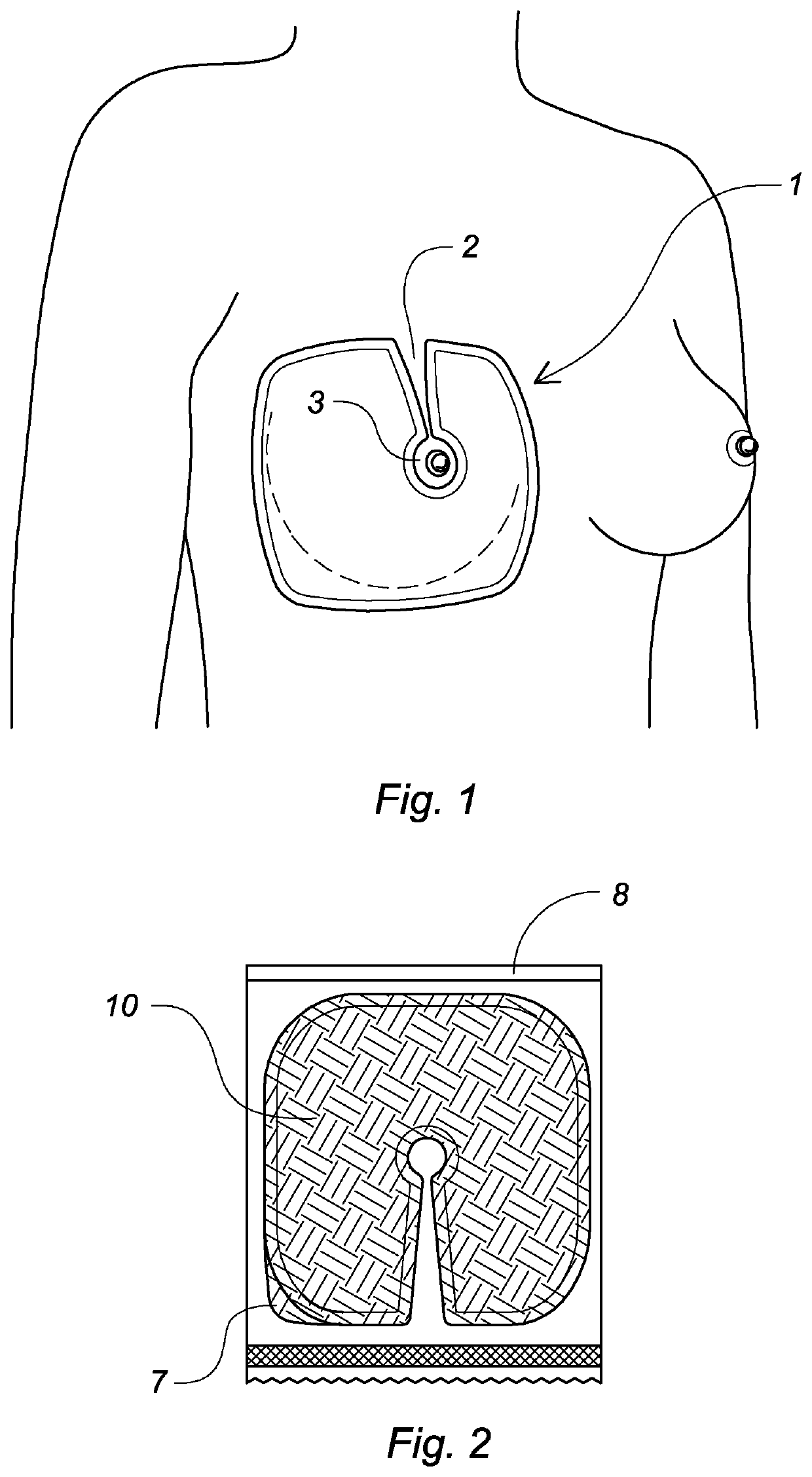 Anesthetic breast pad