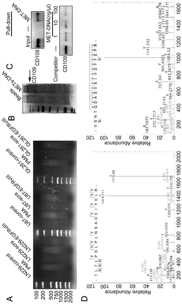 Application of METs as molecular marker in evaluation of clinical prognosis of glioma patient