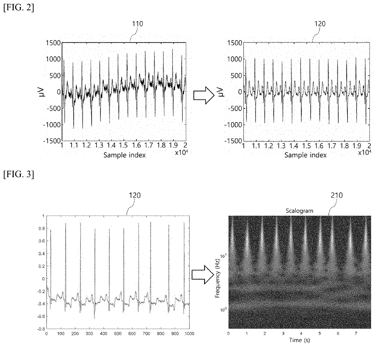 System and method of determining disease based on heat map image explainable from electrocardiogram signal