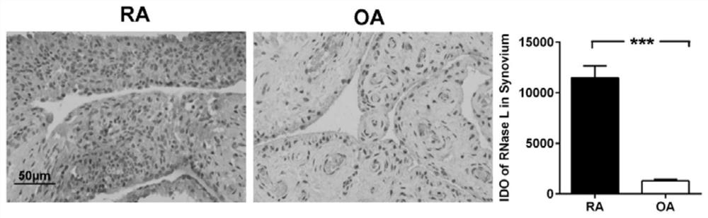 A diagnostic marker for rheumatoid arthritis and its application