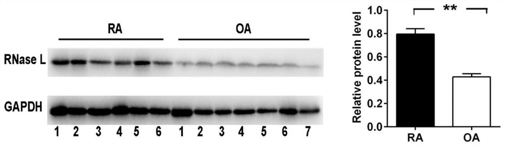 A diagnostic marker for rheumatoid arthritis and its application