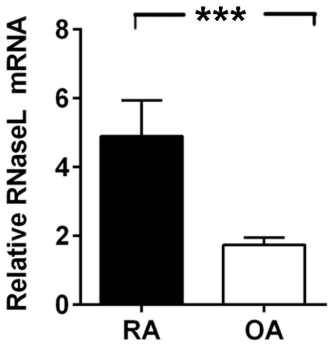 A diagnostic marker for rheumatoid arthritis and its application