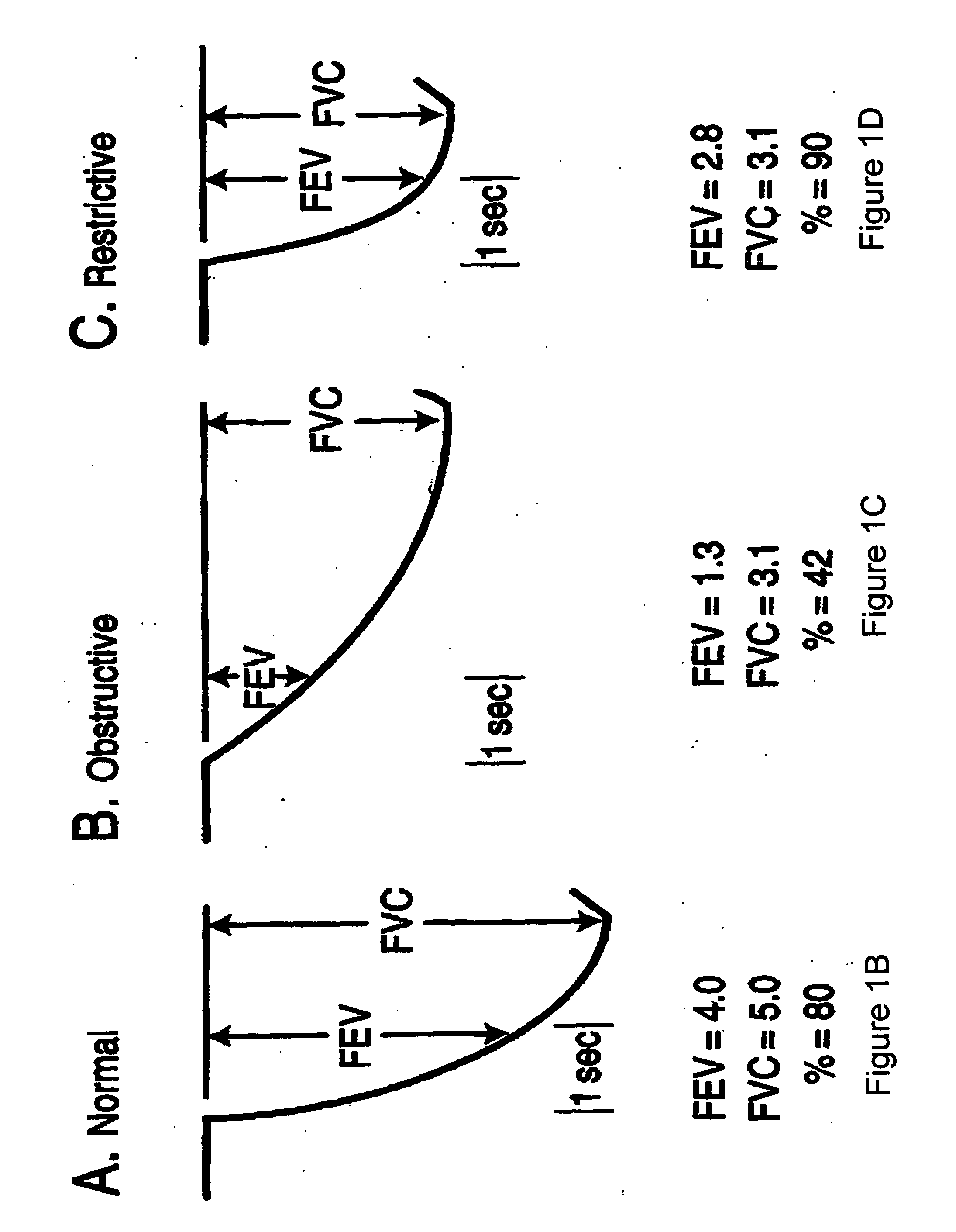 Methods and systems for assessing pulmonary disease with drug therapy control