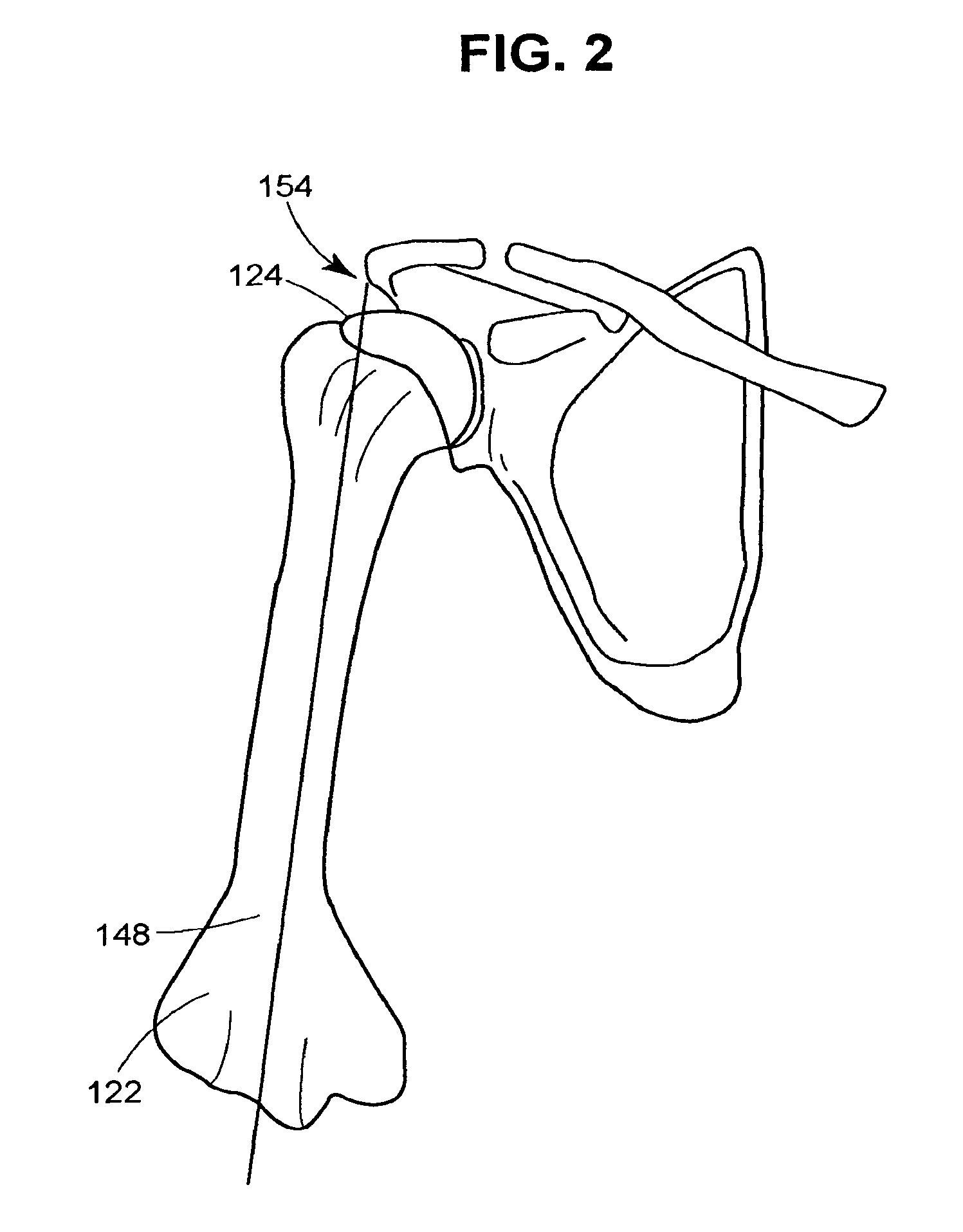 System and method for performing arthroplasty of a joint and tracking a plumb line plane