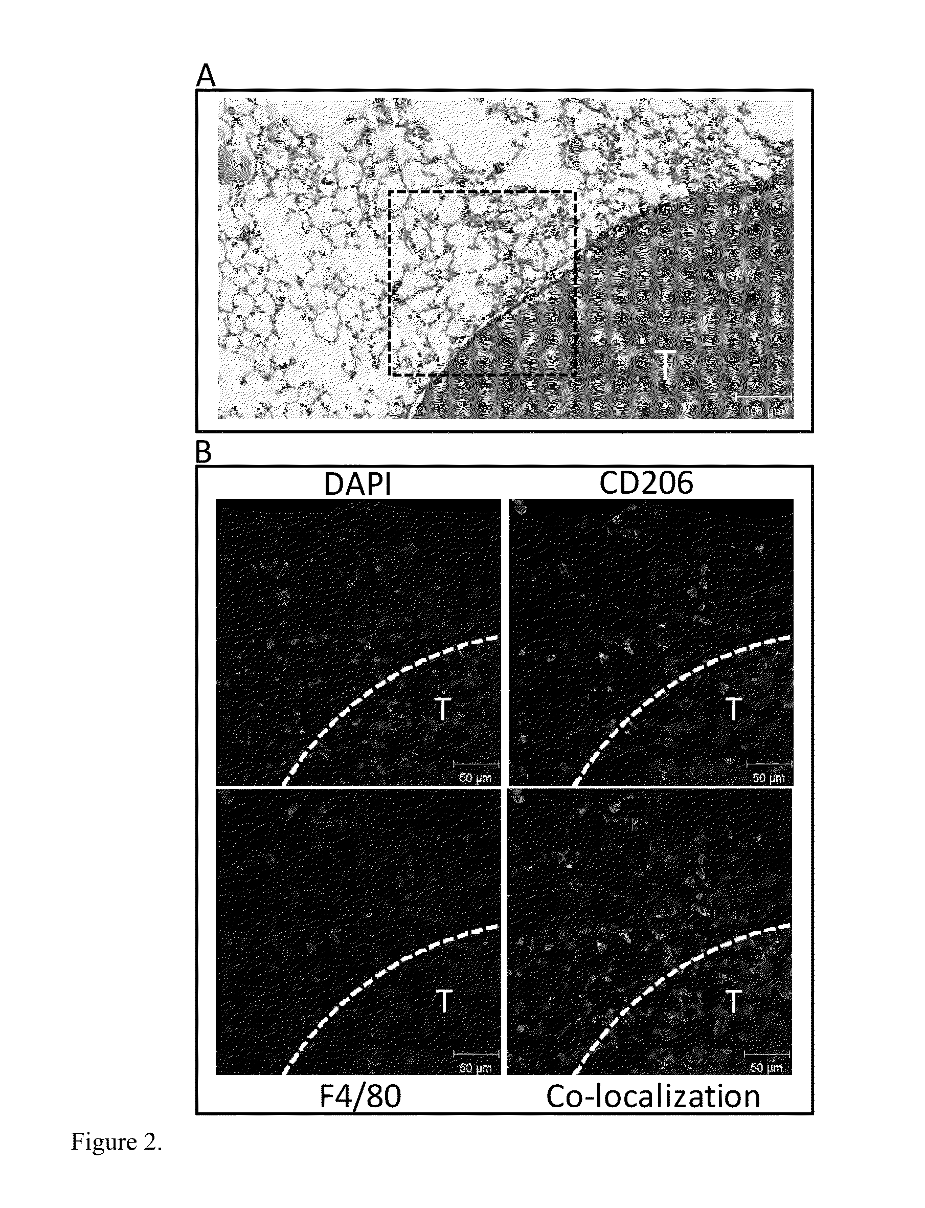Compositions and methods for detecting and treating cancer