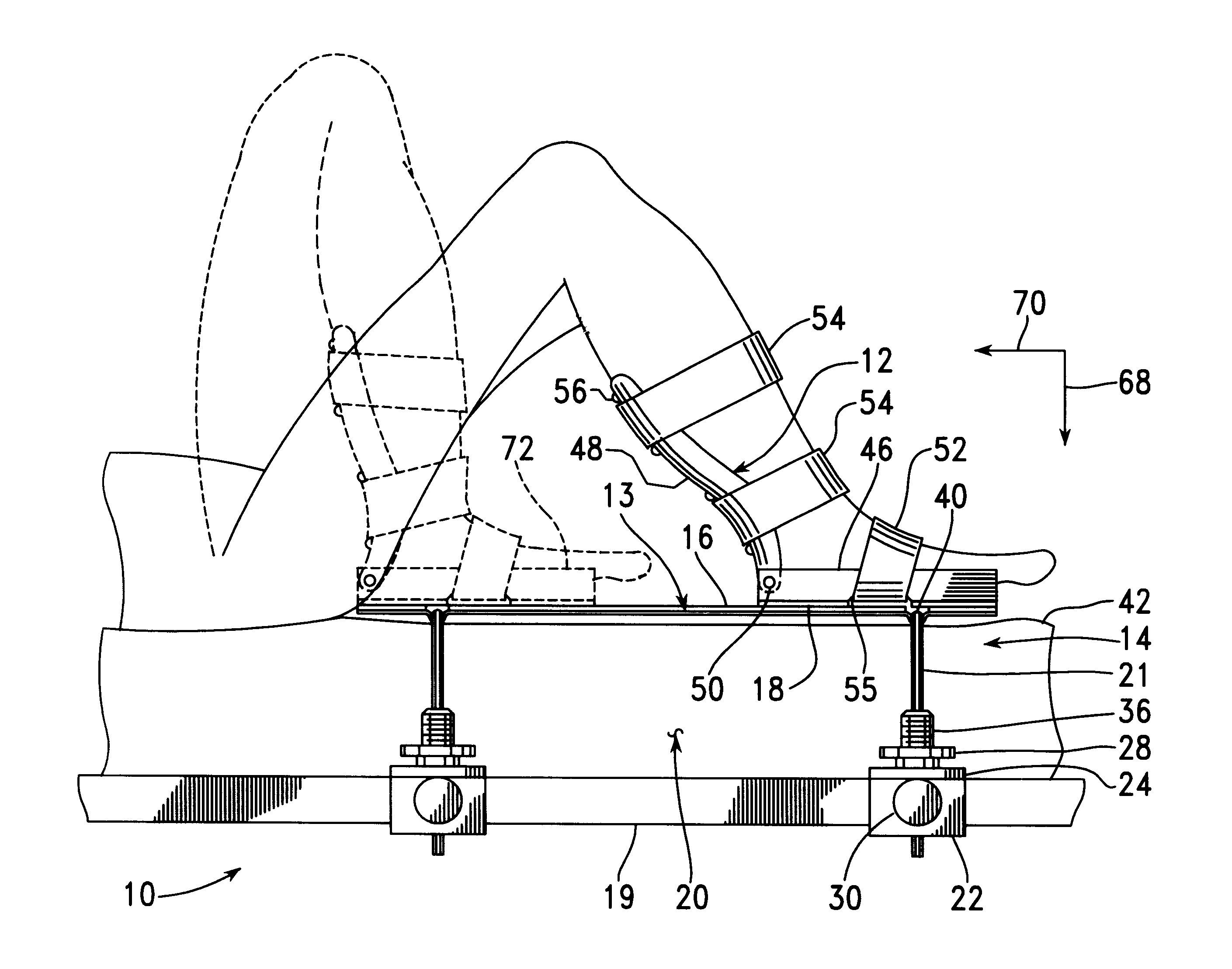 Foot restraint apparatus for holding a leg in place during knee surgery
