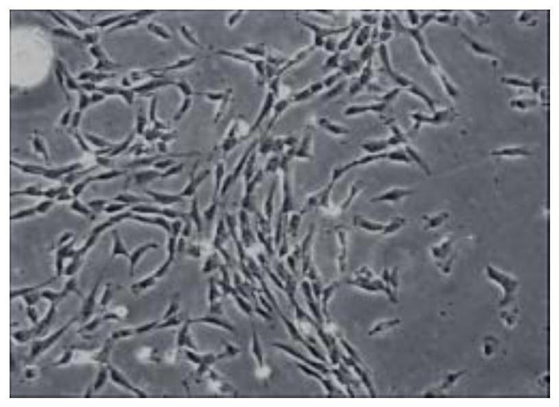 Stem cell cryopreservation method and cell cryopreservation solution used by stem cell cryopreservation method