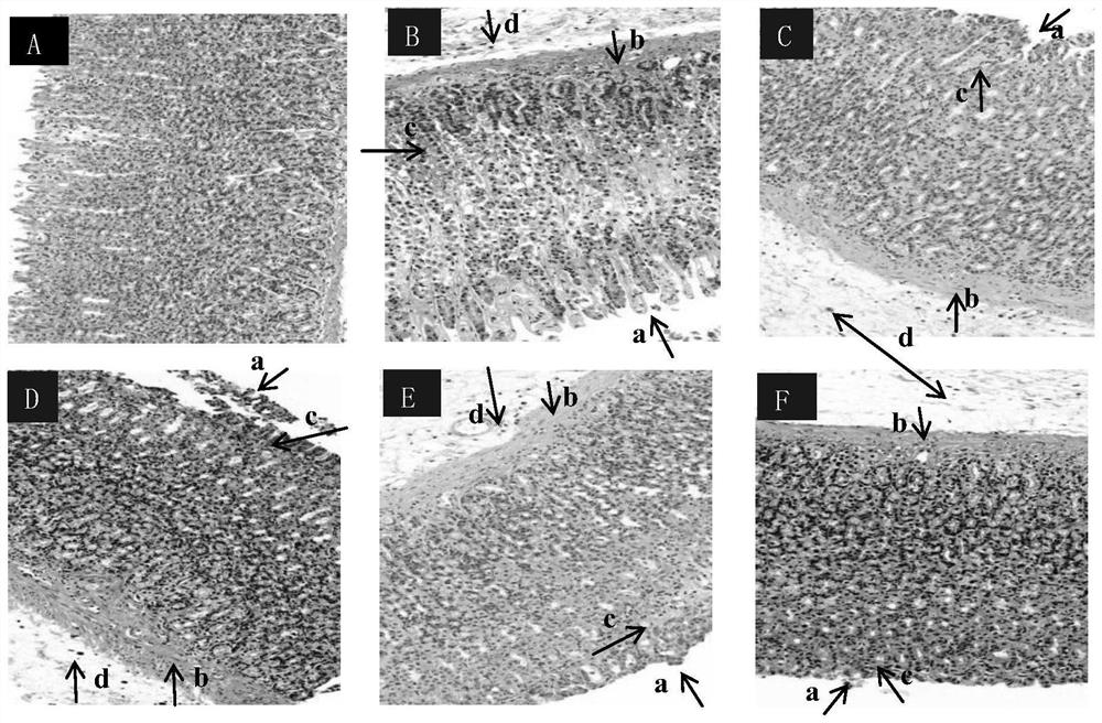 Traditional Chinese medicine for treating gastric ulcer and application thereof