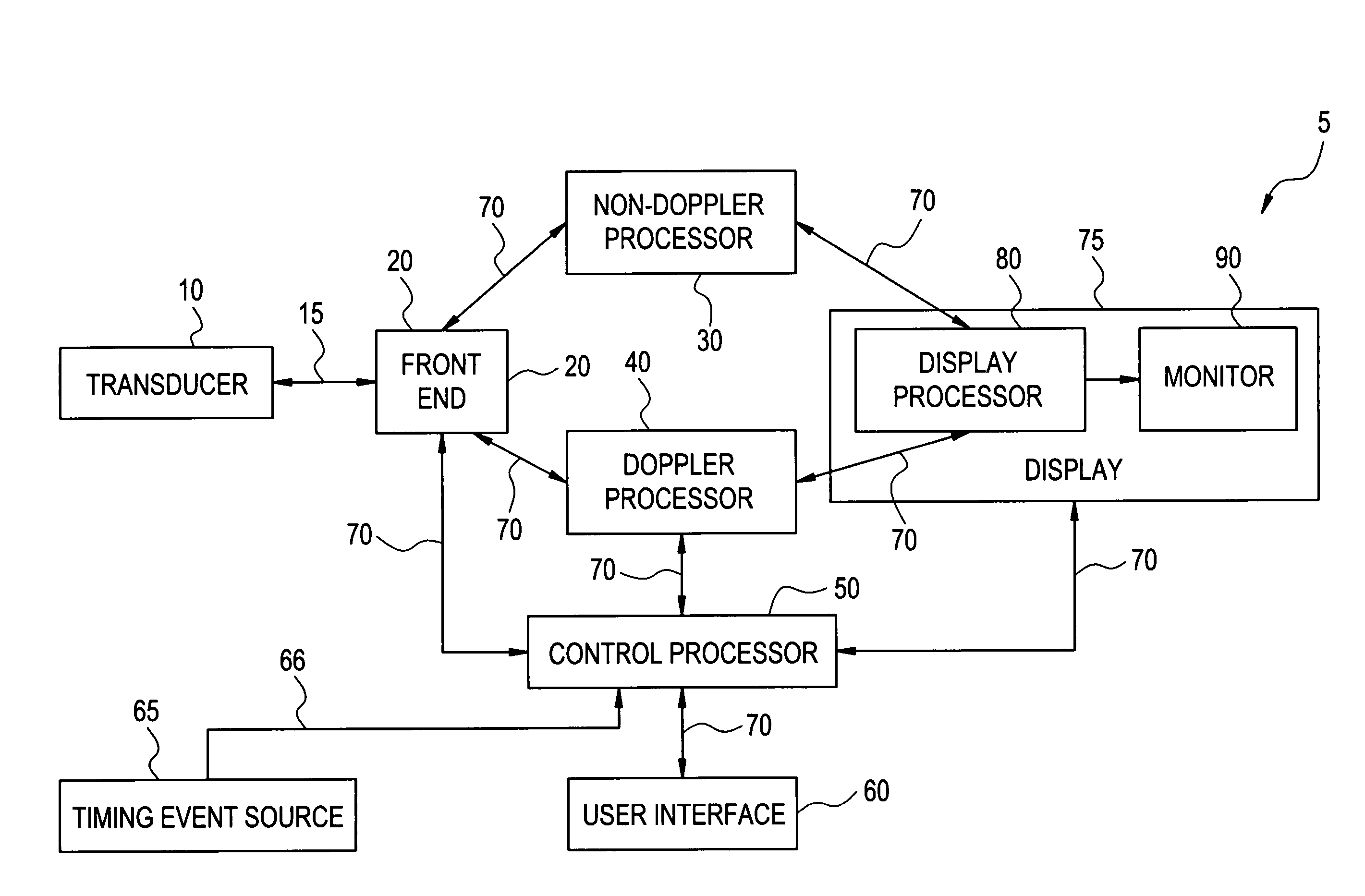 Method and apparatus for natural voice control of an ultrasound machine