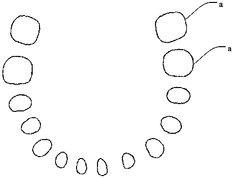 Design method and system of a personalized healing abutment