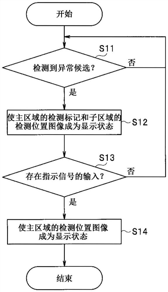 Endoscope diagnosis support system, storage medium and endoscope diagnosis support method