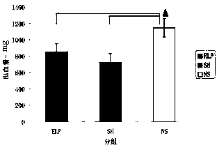 Soft tissue separation preparation prepared from elastin-like polypeptide and application of soft tissue separation preparation