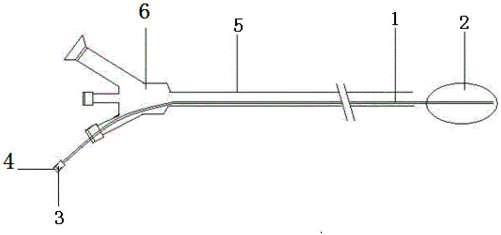 Ureteral stone movement plugging device