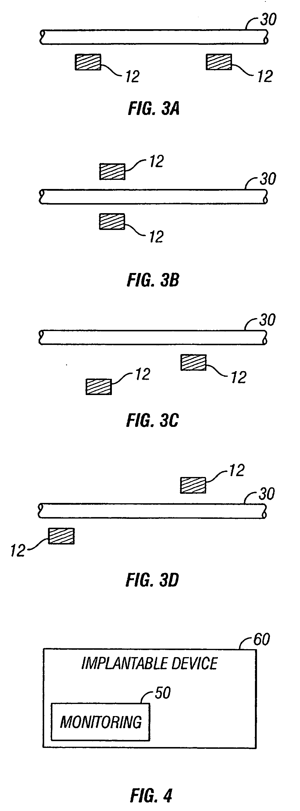 Portable device for monitoring electrocardiographic signals and indices of blood flow
