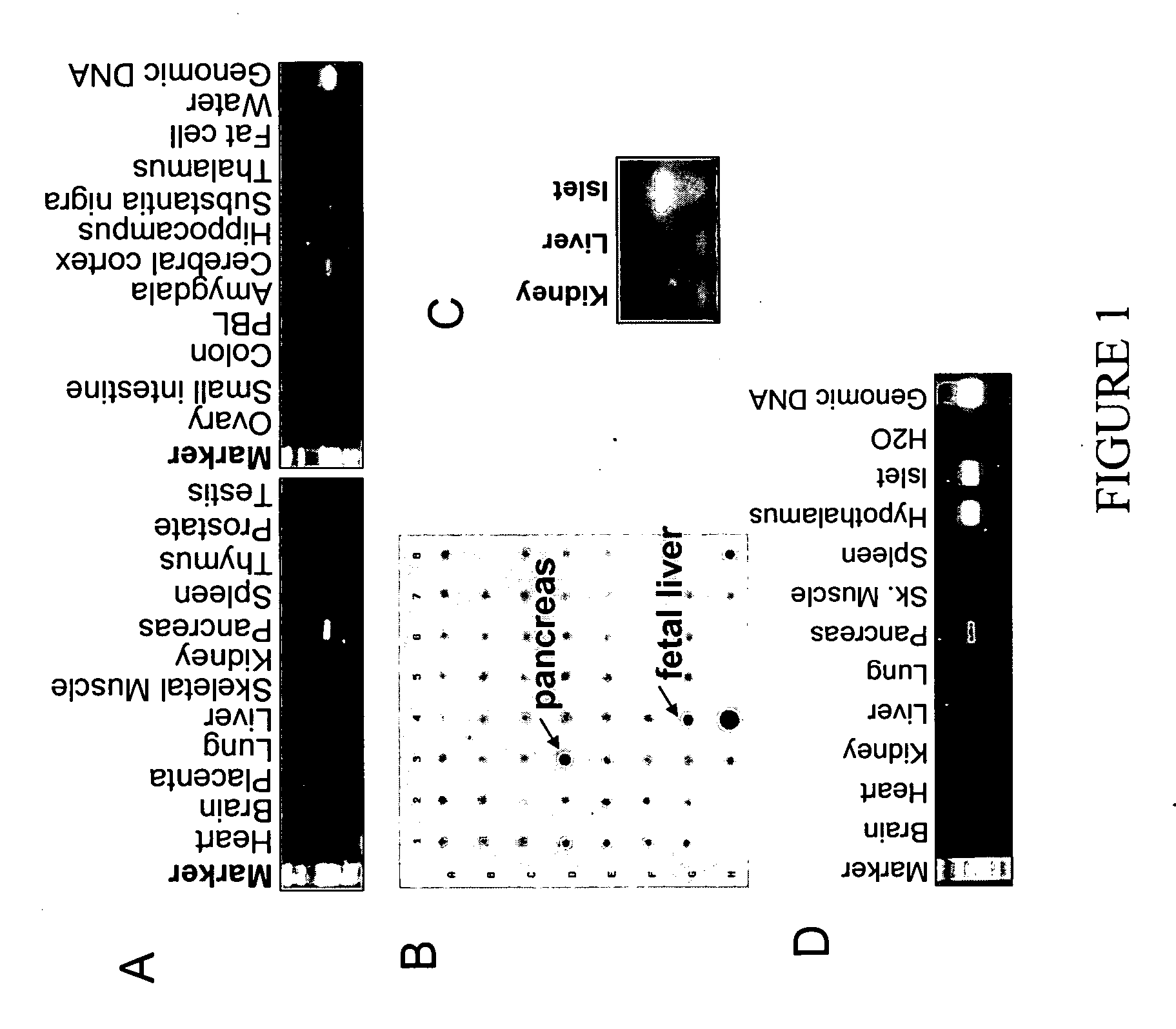 Substituted pyridinyl and pyrimidinyl derivatives as modulators of metabolism and the treatment of disorders related thereto