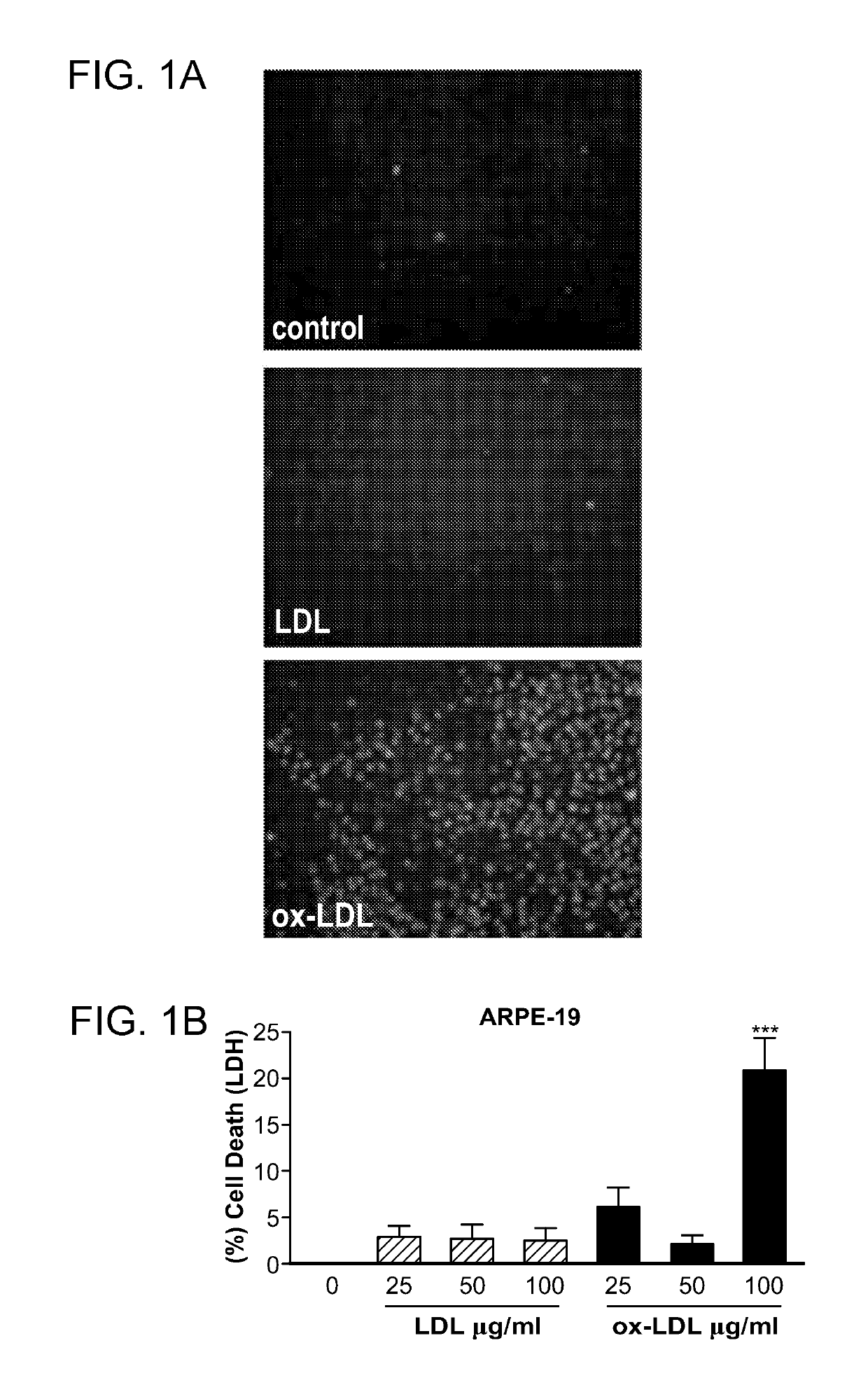 Peroxisome proliferator-activated receptor gamma selective agonists for inhibition of retinal pigment epithelium degeneration or geographic atrophy