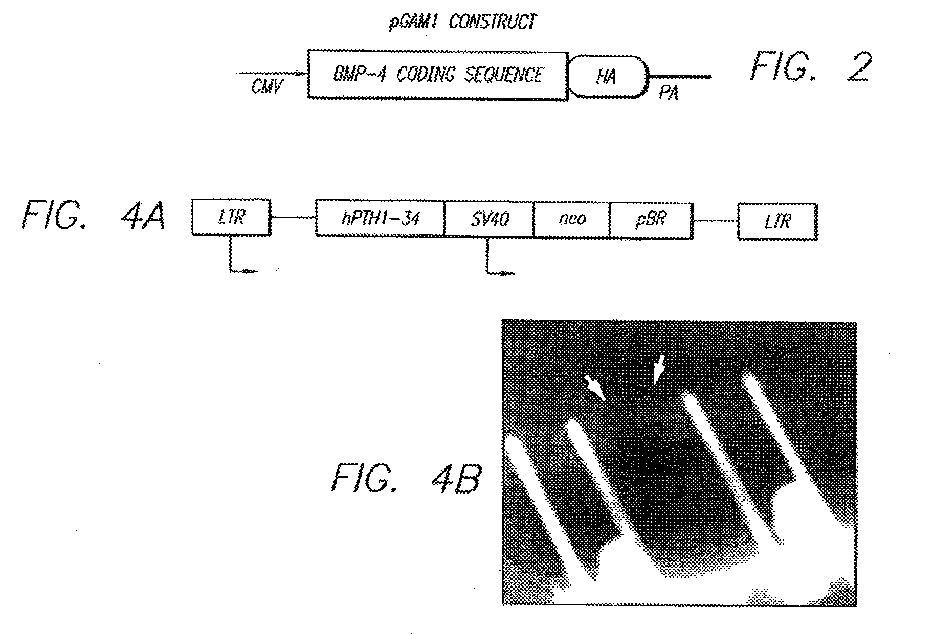 In vivo gene transfer methods for wound healing