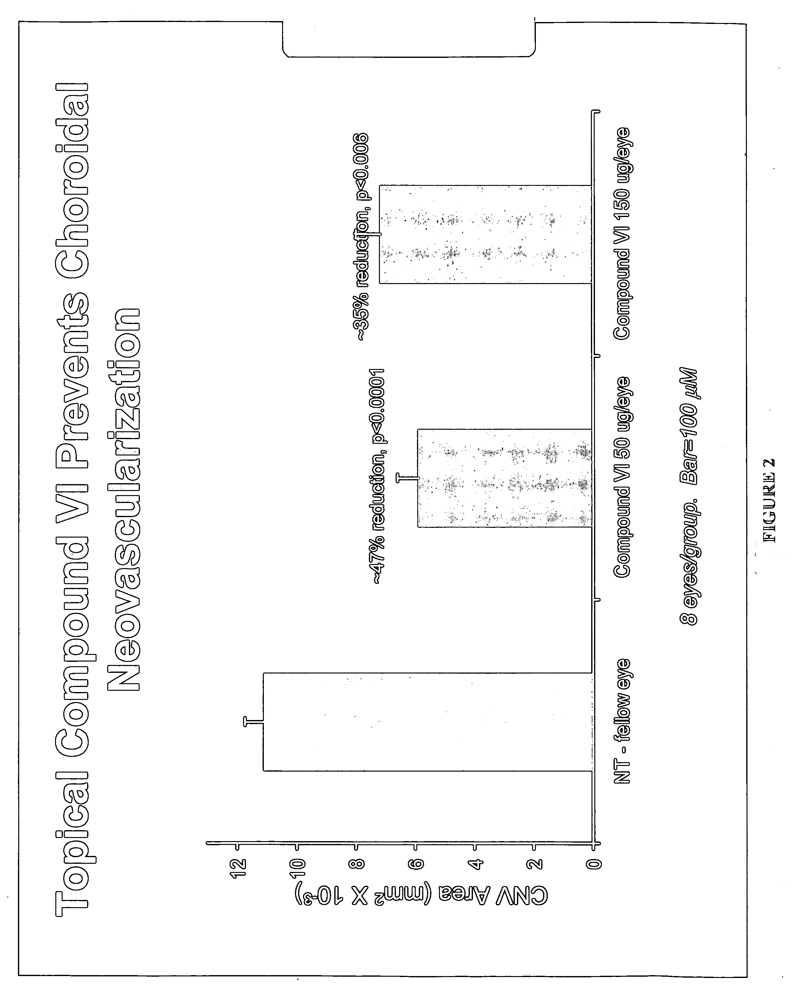 Methods and compositions for the treatment of ocular disorders
