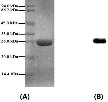 A kind of Periplaneta americana allergen protein ba2 and its expression method