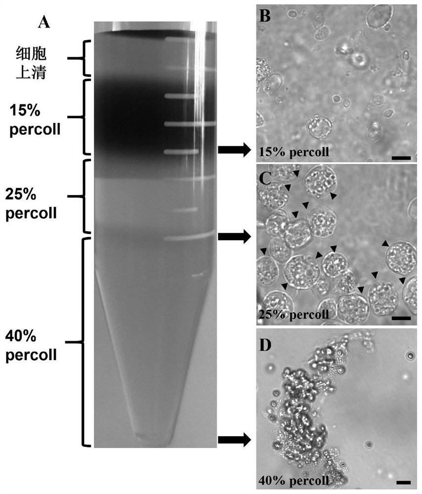 A spermatogonia separation liquid and its application in the separation and purification of spermatogonia