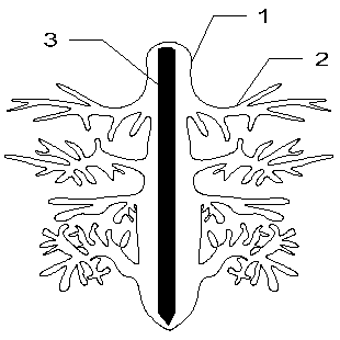 Inserted-rod wind prevention and sand fixation root system, suspension wind prevention and sand fixation root system and support thereof