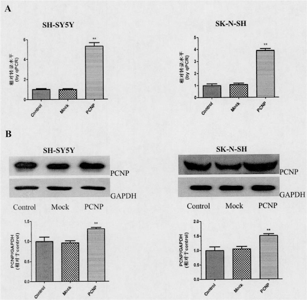 Preparation and application of a drug for overexpressing PCNP gene