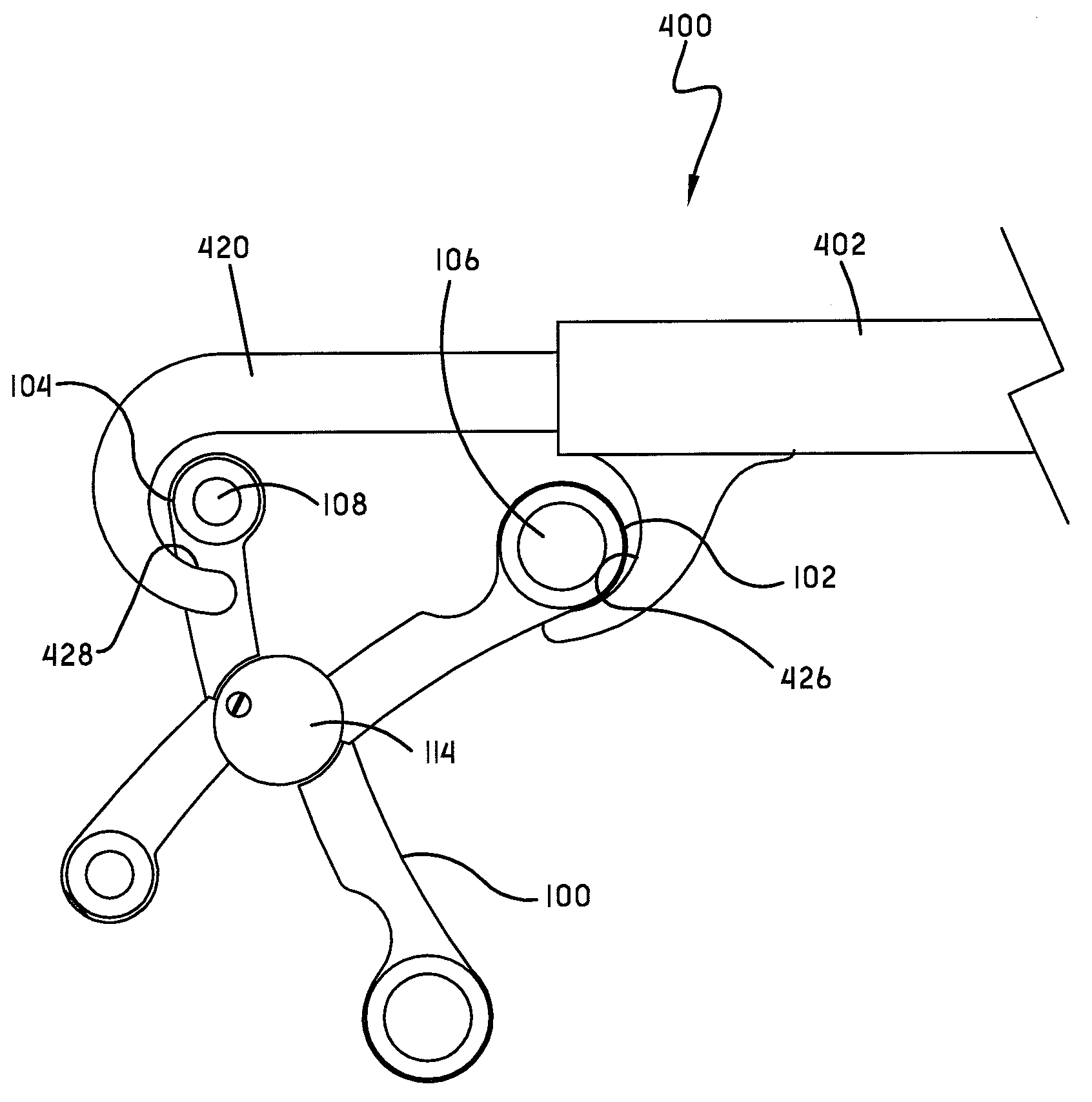 Spine surgery method and extractor
