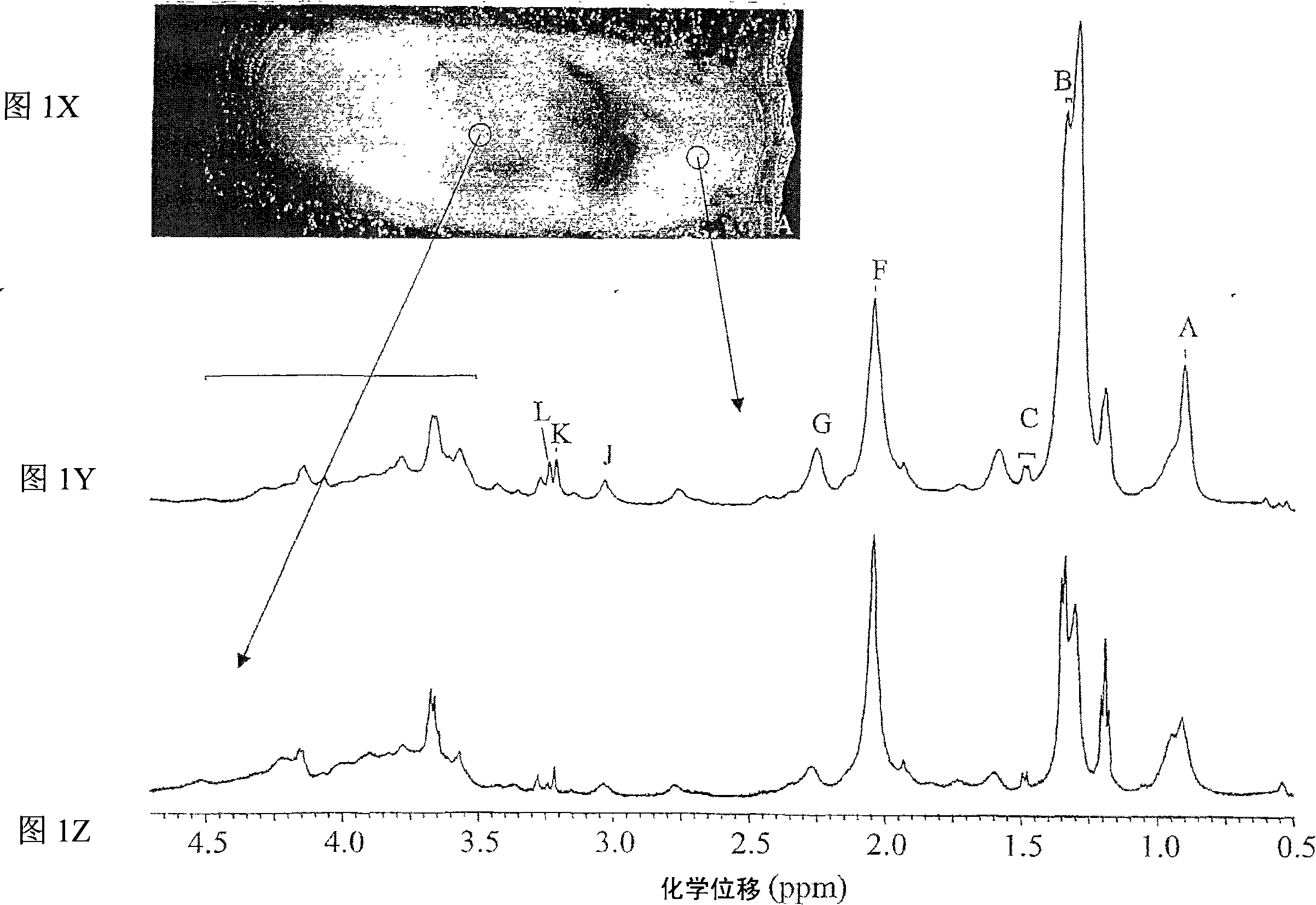 Systems and methods using nuclear magnetic resonance (NMR) spectroscopy to evaluate pain and degenerative properties of tissue
