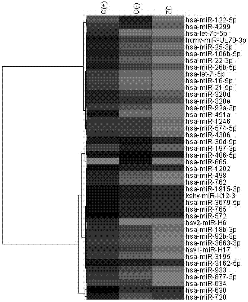 Marker for early diagnosis of cerebral infarction and application thereof