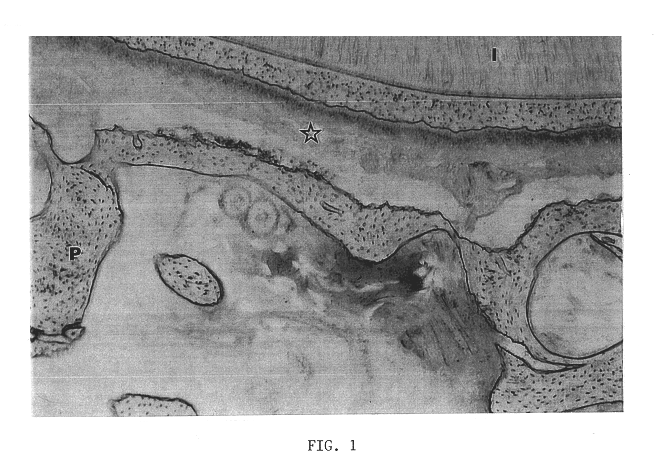 Biological material for treating periodontal diseases