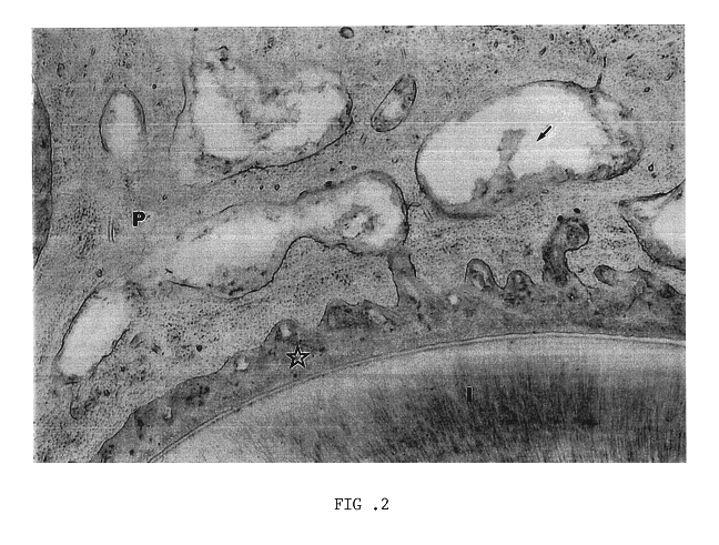 Biological material for treating periodontal diseases