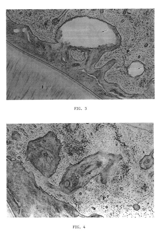 Biological material for treating periodontal diseases