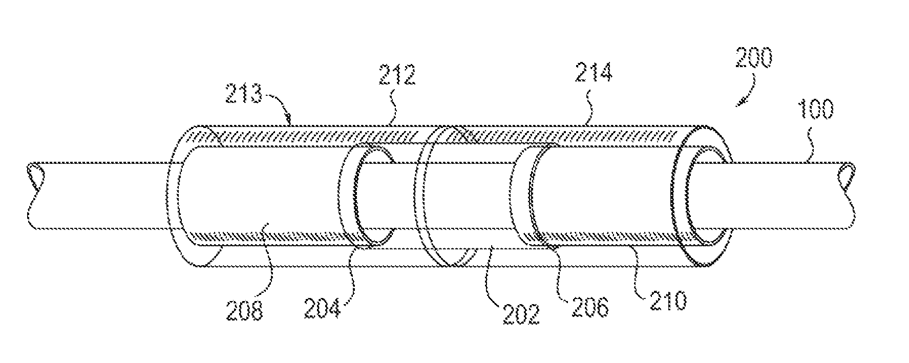Twist-grip anchors and methods of use