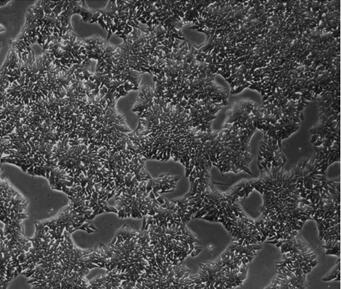 A method for inducing differentiation into NK cells from human embryonic stem cells