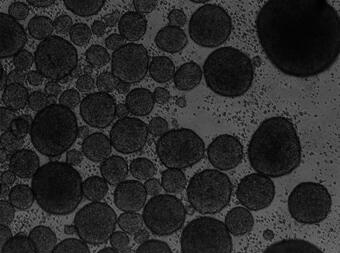 A method for inducing differentiation into NK cells from human embryonic stem cells