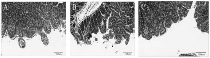 Escherichia coli bacteriophage ZJRP5, application thereof, bactericide and medicine