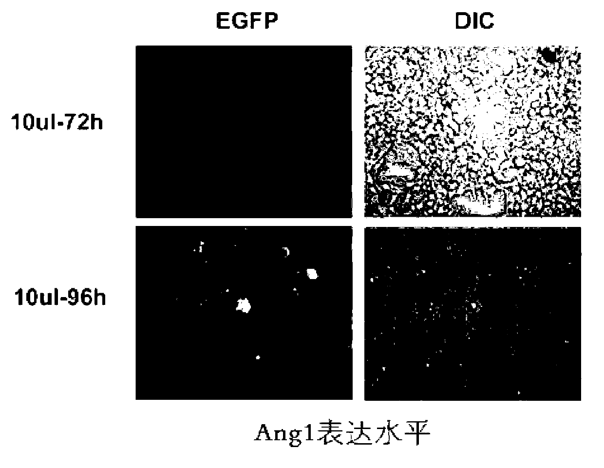 Mesenchymal stem cells genetically modified with angiopoietin 1 gene and construction method and application thereof
