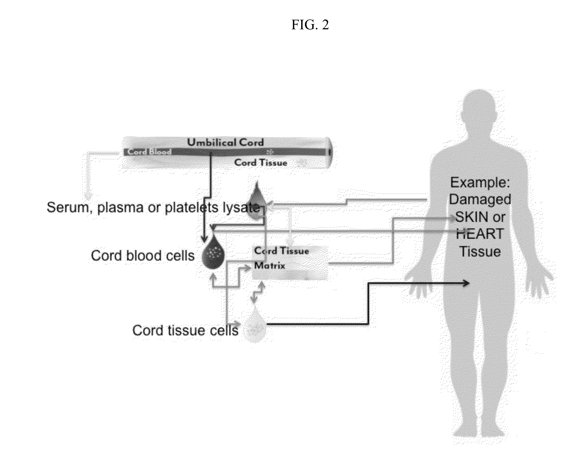 Stem cells & matrix from cord tissue