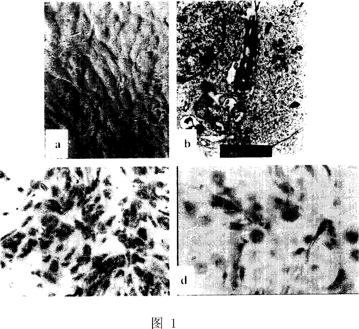 Method for constructing tissue engineering double-layered skin and the application thereof