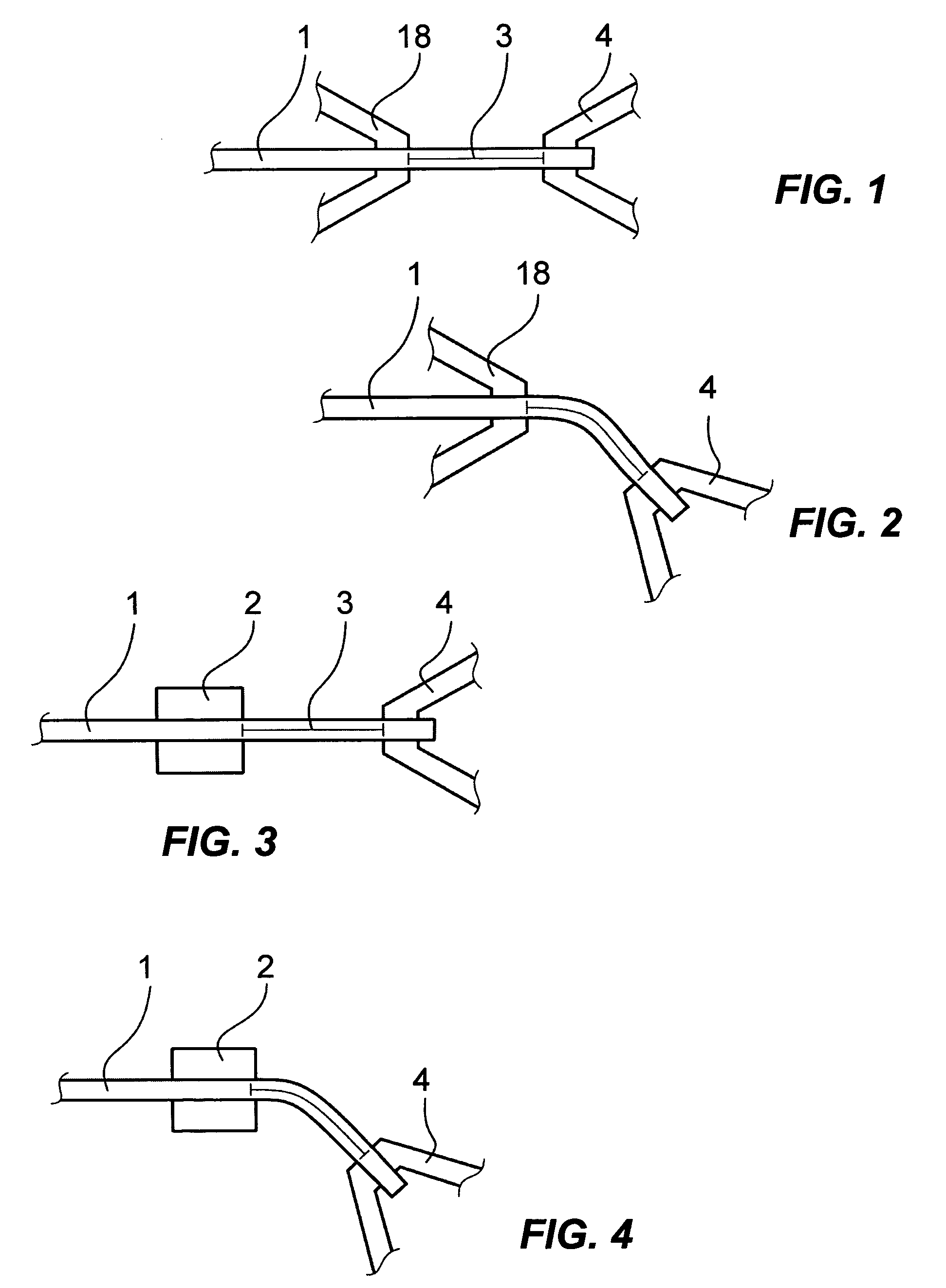 Method and device for shaping an orthodontic archwire