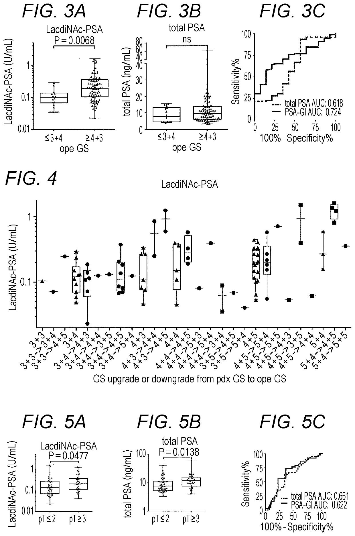 Method for estimating Gleason score of prostate cancer, method for estimating pathological stage, and method for acquiring supplementary information, all on the basis of specific PSA content in specimen
