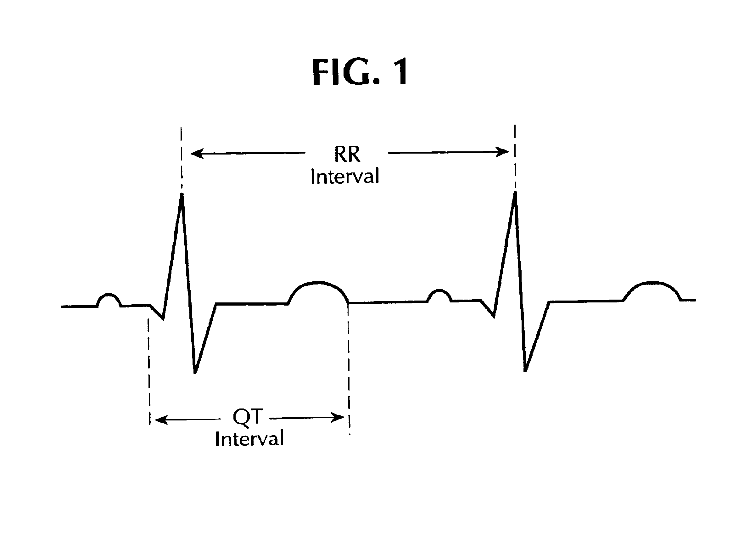 System and method for statistical analysis of QT interval as a function of changes in RR interval