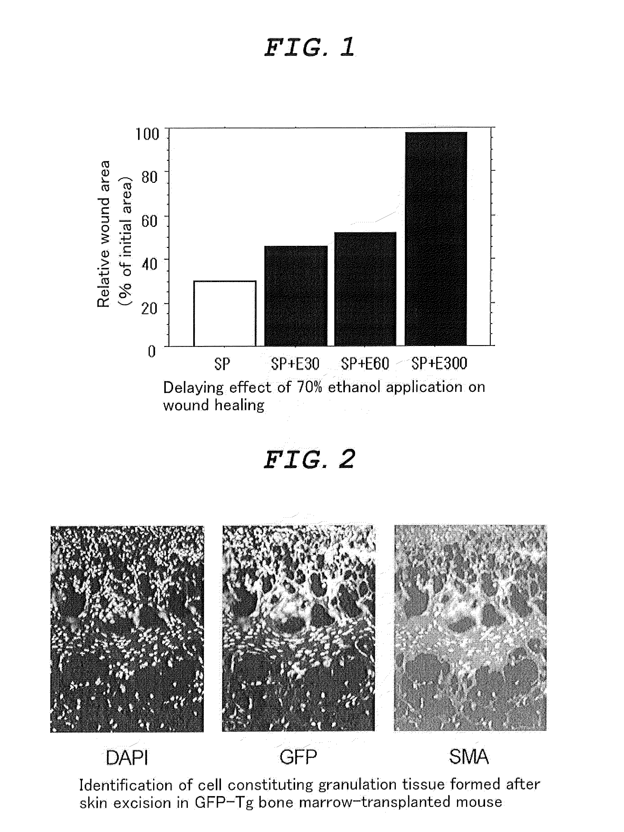 External Agent for Treatment of Skin Ulcer