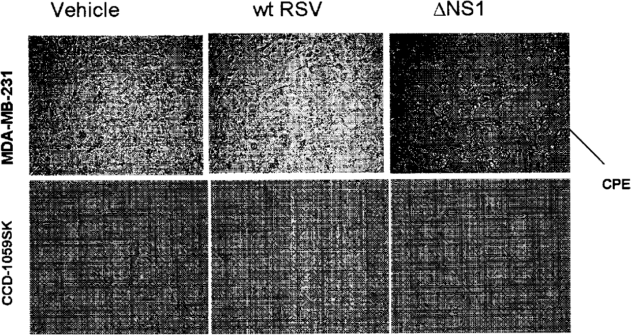 Gene NS1 (Structural Protein) defective respiratory syncytial virus and application thereof
