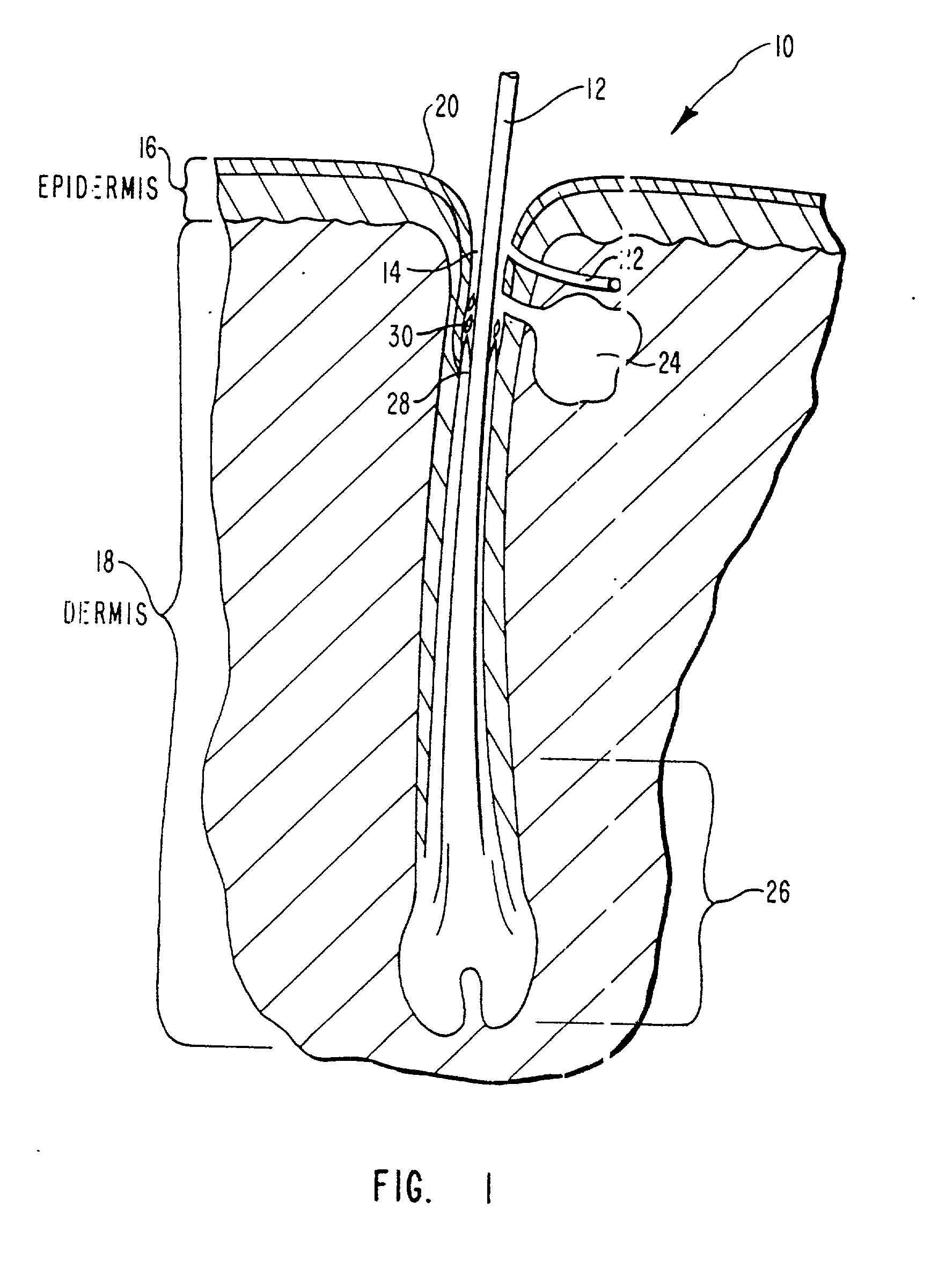 Skin treatment with a water soluble antibiotic dissolved in an electrolyzed water