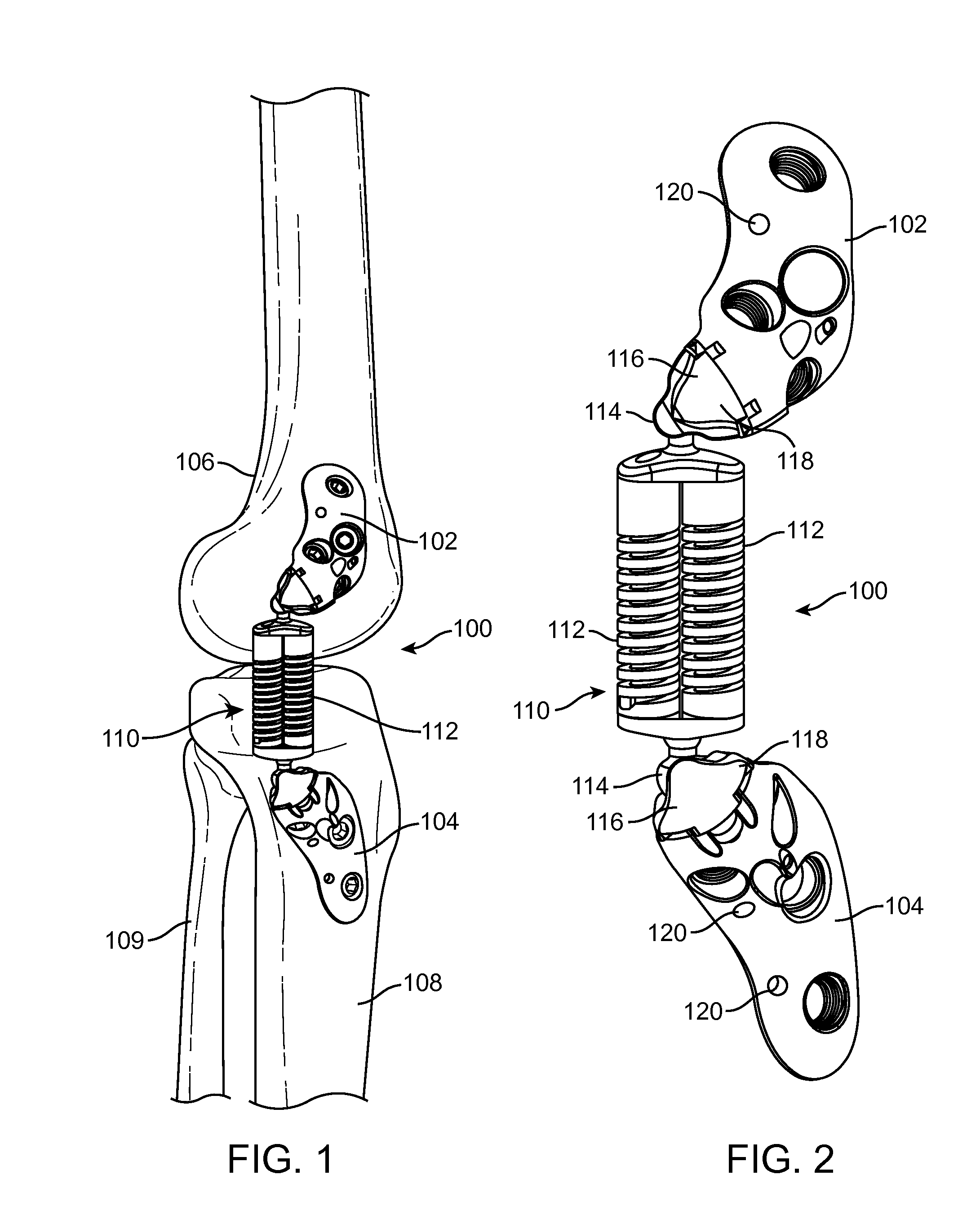 Methods and Devices for Joint Load Control During Healing of Joint Tissue